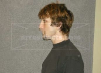Thomas J Micolichek