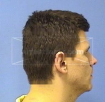 Anthony Dean Moriello