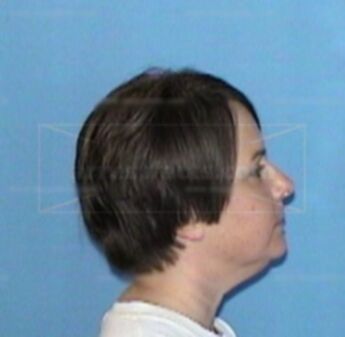 Janene L. Patton