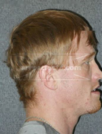 Jerid D Putzke