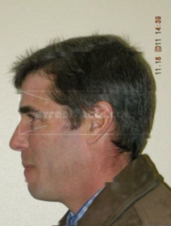 David W Feldstein