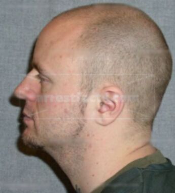 Michael D Hacker
