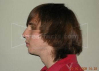 Justin J Anderson