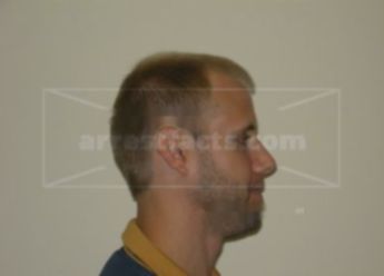 Brian A Buettner