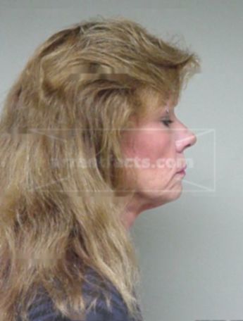 Laurel J Holbach