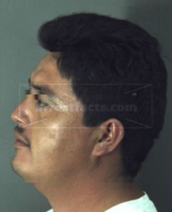 Carlos Trejo