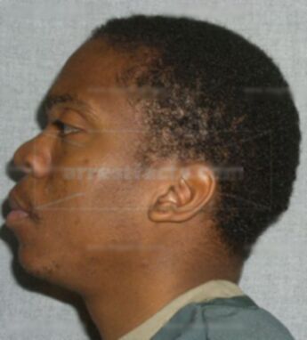 Darrell D Garrett