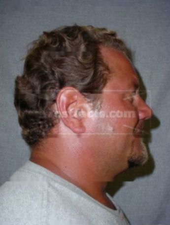Rodney J Staeven