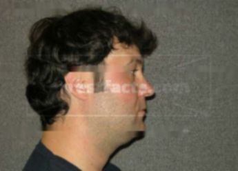 Adam A Lehmann