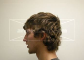 Joshua L Hetzel