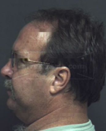 Jeffrey Howard Laws