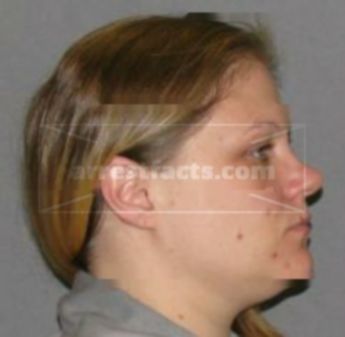 Amy Lynn Bradberry
