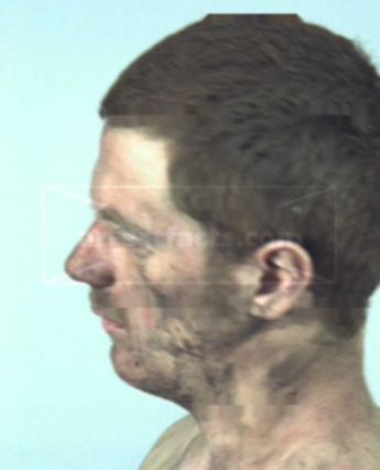 Brandon Dale Yates