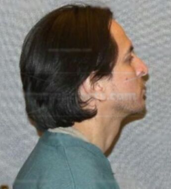 Hugo A Del Portillo Jr.