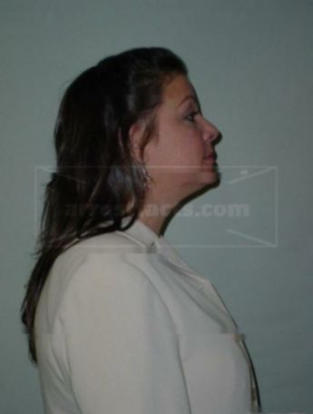 Lori A Levine