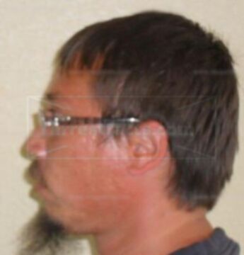 Matthew T Cornett