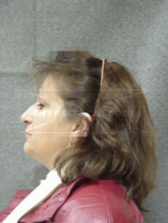 Ann M Derousseau