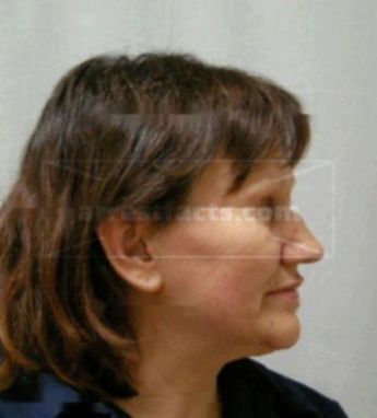 Kim M Fannin