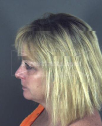 Melinda Joyce Lesser