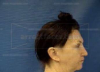Debra Lynn Shields