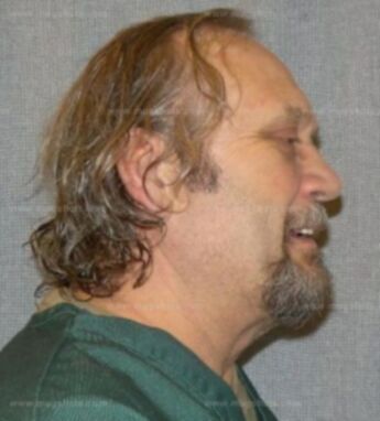 David G Pfeifer