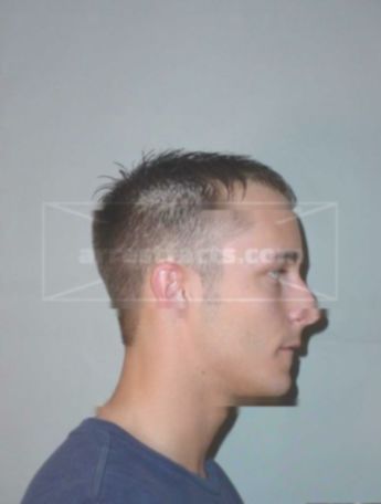 Teague Marko