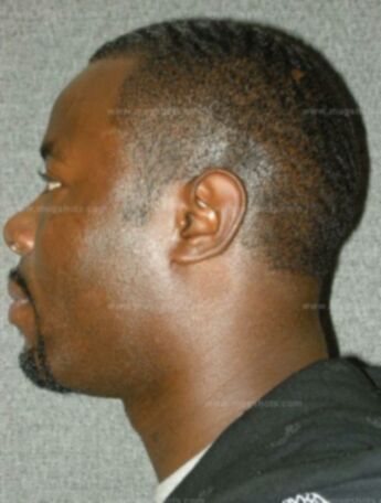 Andrew L Coleman