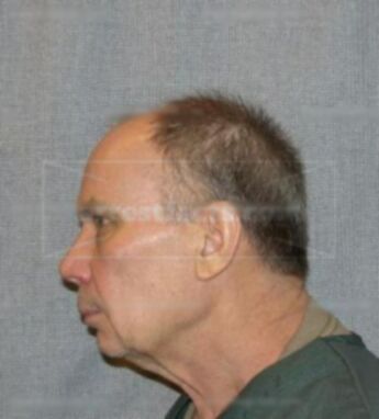 Charles J Blankenheim