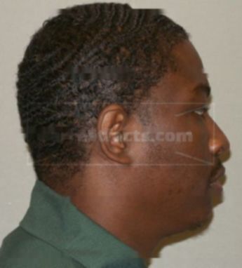 Deon M Morris