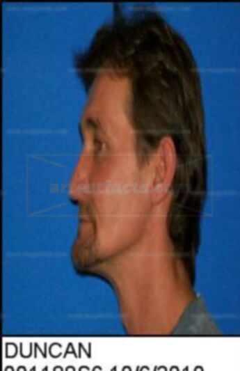 Johnny Lee Duncan