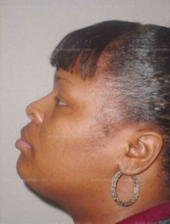 Zelma D Gray