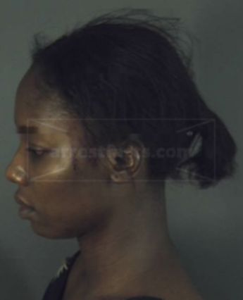 Charlesina Mathurin