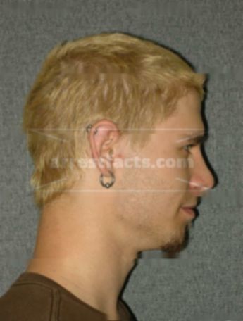 Collin D Berlik