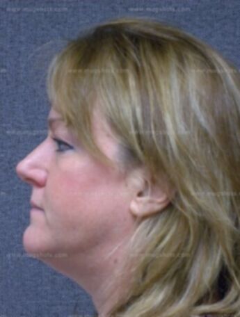 Michele L Knudtson