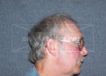 Douglas G Siltman