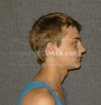 Tanner M Diercks