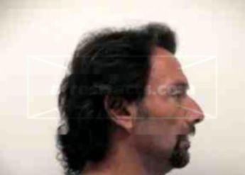 Guy Filippone