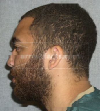 Tyrone J Malone