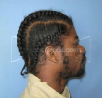 Cordaro Guyton