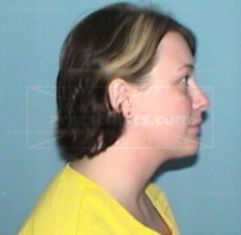 Melissa Beale