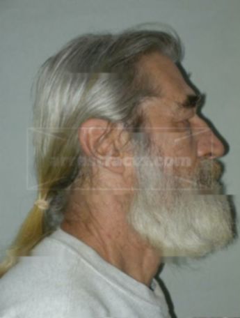 John K Lipka