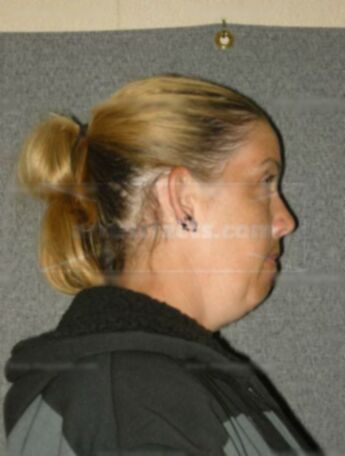 Nichole D Borchardt
