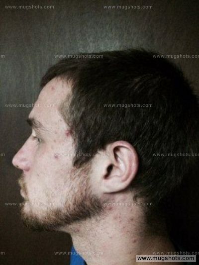 Aaron M Burton