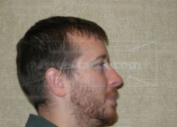 Ryan D Schmoldt