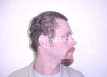 Matthew T Benton