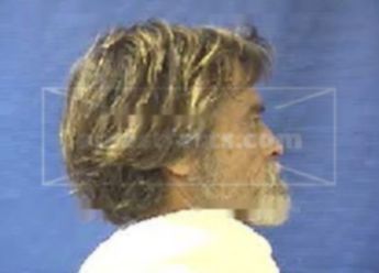 Mark Allen Burkman
