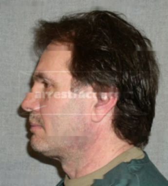 Bruce L Wickline
