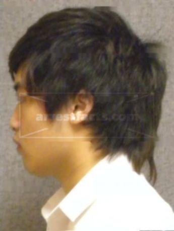 Maxwell L Yang