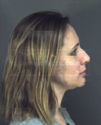 Melissa Marie Coker