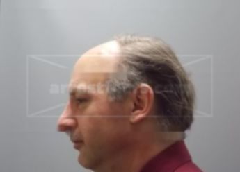 Tod M Zoromski